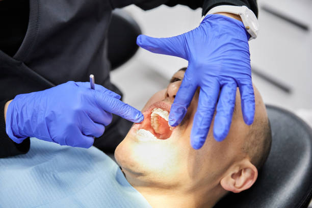 Best Emergency Treatment for Toothache in Marshall, TX