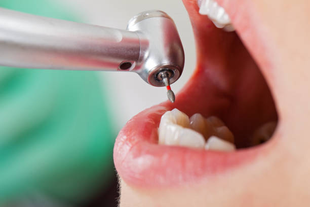 Best Walk-In Emergency Dentist in Marshall, TX